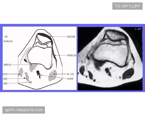 加维半月板受伤引关注，俱乐部宣布将进行详细检查与治疗